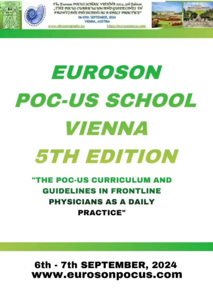 Euroson PoC-US news